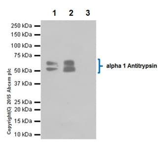 Anti-alpha 1 Antitrypsin antibody [EPR17087-50](AB207303)