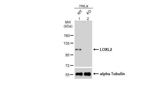Loxl2 Antibody Ab96233  Western Blot Img445728