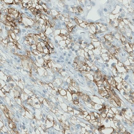 Carbonic Anhydrase 12 Ca12 Antibody Cl0278 Ab242316  Immunohistochemistry Formalin Pfa Fixed Paraffin Embedded Sections Img119441