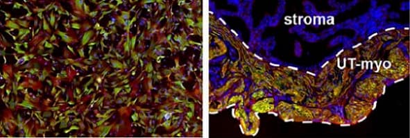 Anti-Calponin 1 antibody [EP798Y](AB46794)