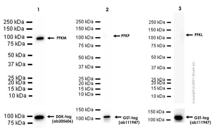 Anti-PFKM antibody [EPR10734(B)] - BSA and Azide free(AB232495)