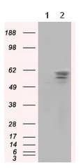 Pank2 Antibody Oti3h9 Ab119070  Western Blot Img8157
