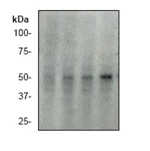 Anti-p53 (phospho S392) antibody [EP155Y] - BSA and Azide free(ab239211)