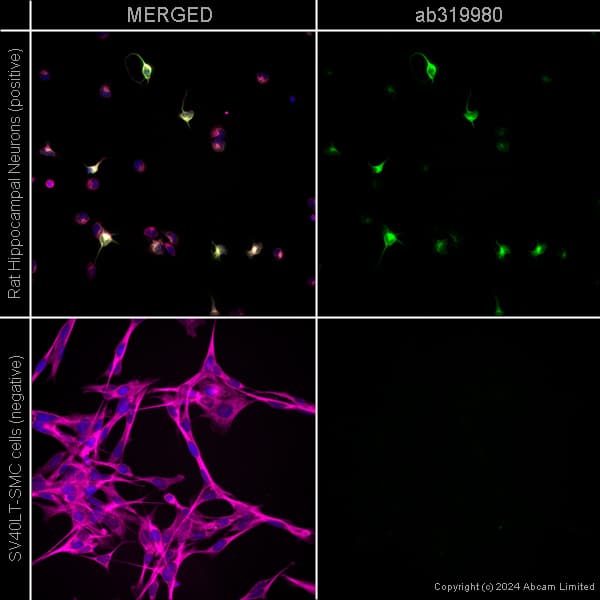 Alexa Fluor 594 Alpha Tubulin Antibody Ep1332y Microtubule Marker Ab202272  Immunocytochemistry Immunofluorescence Img433792