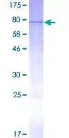 Recombinant Human Cytochrome P450 3A4/CYP3A4 protein(AB114327)