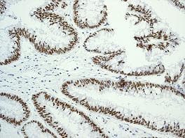 Anti-Topoisomerase I antibody [EPR5375](AB109374)