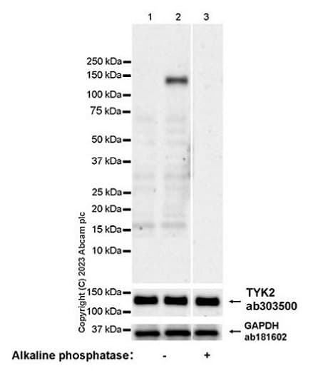 Anti-TYK2 antibody [EPR24628-106](AB303500)