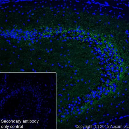 Anti-GAD65 + GAD67 antibody [EPR19366](AB183999)
