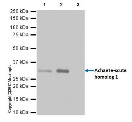 Anti-MASH1/Achaete-scute homolog 1 antibody [EPR19840](AB211327)