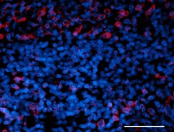 Anti-Nuclear Pore Complex Proteins antibody [Mab414](AB24609)