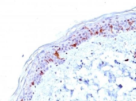 Cd1a Antibody O10 Ab233990  Immunohistochemistry Formalin Pfa Fixed Paraffin Embedded Sections Img100394