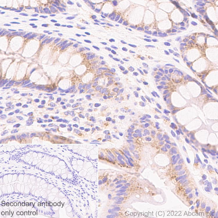 Anti-GM130 antibody [EP892Y] - Chicken IgY (Chimeric)(AB302489)