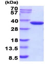 Recombinant E. coli Glucokinase protein (Active)(AB208303)