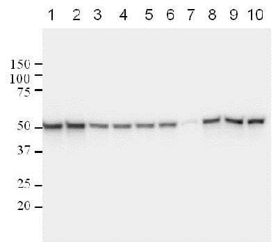 Anti-p53 antibody [DO-1] - ChIP Grade(AB1101)