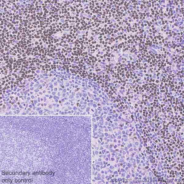 Anti-Ctip2 antibody [EPR23120-25](AB240636)