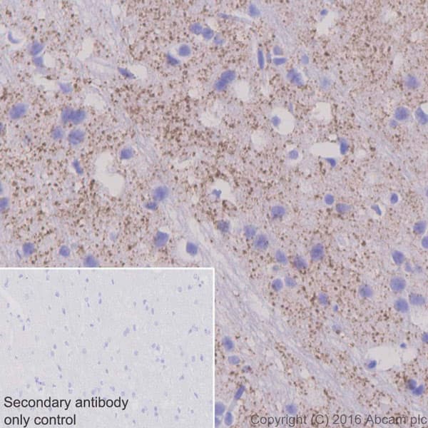 Anti-Tyrosine Hydroxylase antibody [EP1532Y] - Neuronal Marker(AB137869)