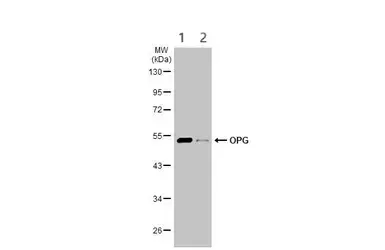 Anti-Osteoprotegerin antibody(AB183910)