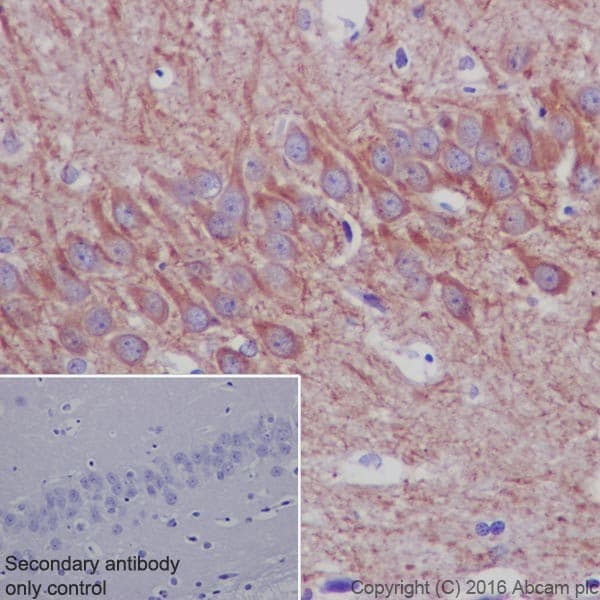 Anti-MAP2 antibody [EPR19691](AB183830)