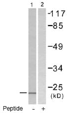 Anti-gamma Synuclein/SNCG antibody(AB55424)