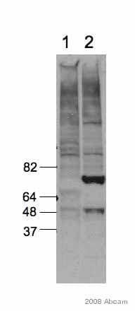 Anti-p53 antibody [PAb 240](AB26)
