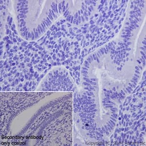 Loricrin Antibody Epr71492 C Terminal Ab198994  Immunohistochemistry Formalin Pfa Fixed Paraffin Embedded Sections Img68375