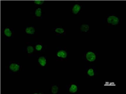 Anti-SATB1 + SATB2 antibody [SATBA4B10] - C-terminal(ab51502)