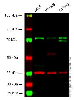 Anti-PKC zeta antibody [EP1490(2)](AB108970)