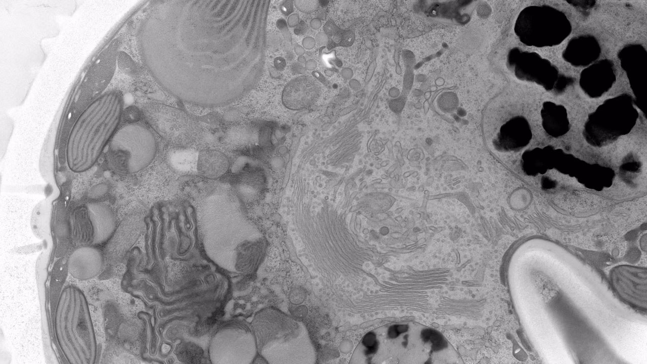 Micrograph Of A Dinoflagellate Cell Kid21767838