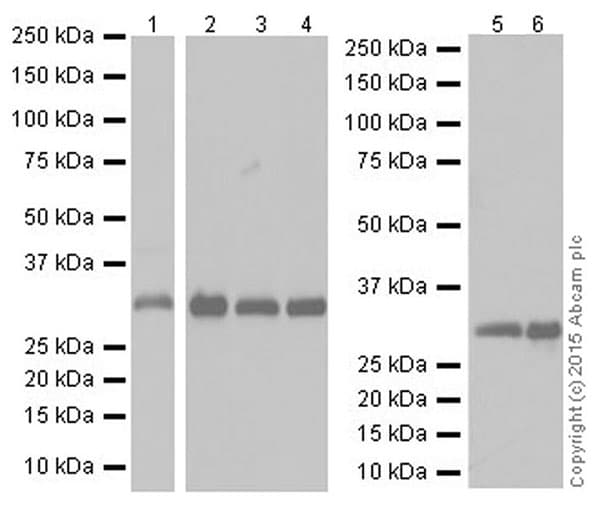 Anti-CNOT7 antibody [EPR18722](AB195587)