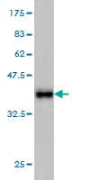 Idh2 Antibody 5f11 Ab55271  Western Blot Img153334