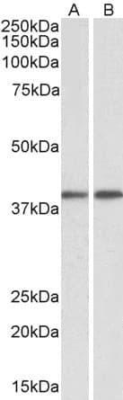 Anti-GNAQ antibody(AB113429)