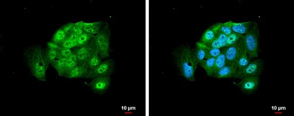 Argonaute 2 Antibody Ab226943  Immunocytochemistry Immunofluorescence Img14472