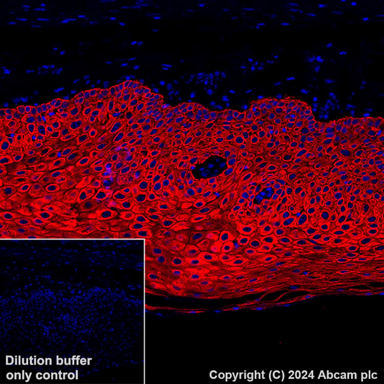 Alexa Fluor 647 Cytokeratin 5 Antibody Ep1601y Ab193895  Immunohistochemistry Formalin Pfa Fixed Paraffin Embedded Sections Img448920