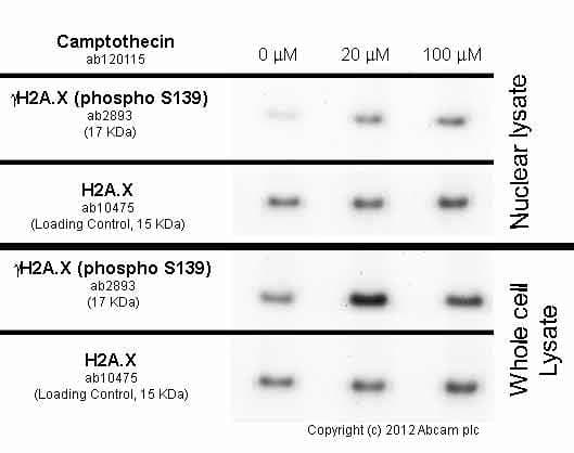 Anti-gamma H2A.X (phospho S139) antibody(AB2893)