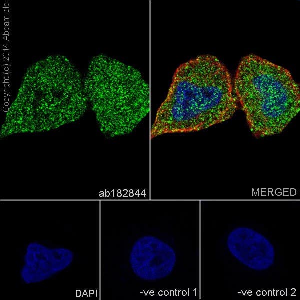 Hsp70 Antibody Epr17677 Ab182844  Immunocytochemistry Immunofluorescence Img14175