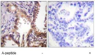 Crebbp Acetyl K1535 Antibody Ab61242  Immunohistochemistry Formalin Pfa Fixed Paraffin Embedded Sections Img17060