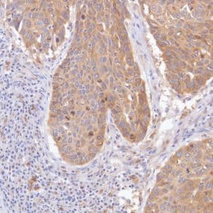 Gpnmb Antibody Sp299 Bsa And Azide Free Ab272016  Immunohistochemistry Formalin Pfa Fixed Paraffin Embedded Sections Img137508