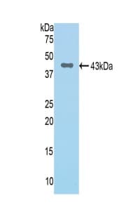 Factor B Antibody Ab231072  Western Blot Img24386