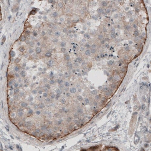 Anti-LAMA1 antibody [CL3087](AB210954)