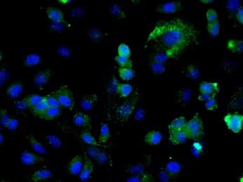 Integrin Linked Ilk Antibody Ab217025  Immunocytochemistry Immunofluorescence Img128950