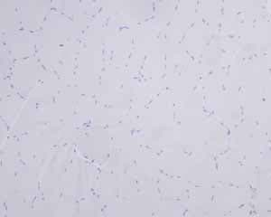 Anti-Myelin Basic Protein antibody [EPR6652](AB133620)