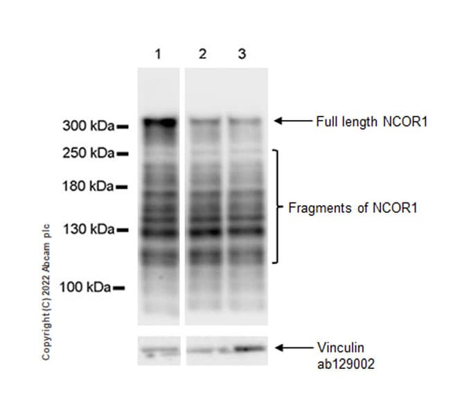 Nuclear Receptor Corepressor Ncor Antibody Epr23834 46 Bsa And Azide Free Ab300616  Western Blot Img405628