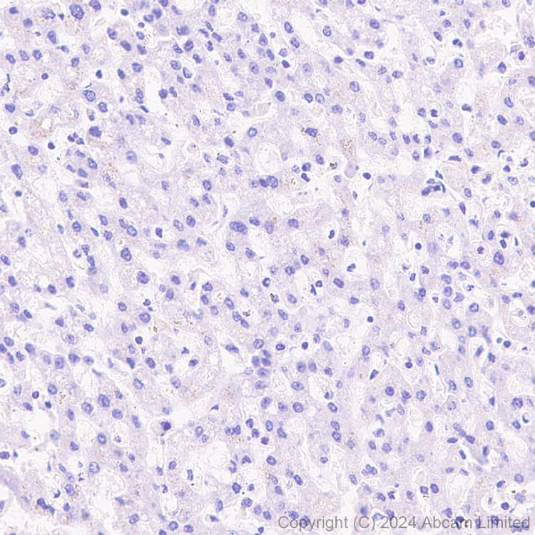Atp6v0d2 Antibody Epr29173 521 Bsa And Azide Free Ab321810  Immunohistochemistry Formalin Pfa Fixed Paraffin Embedded Sections Img435568