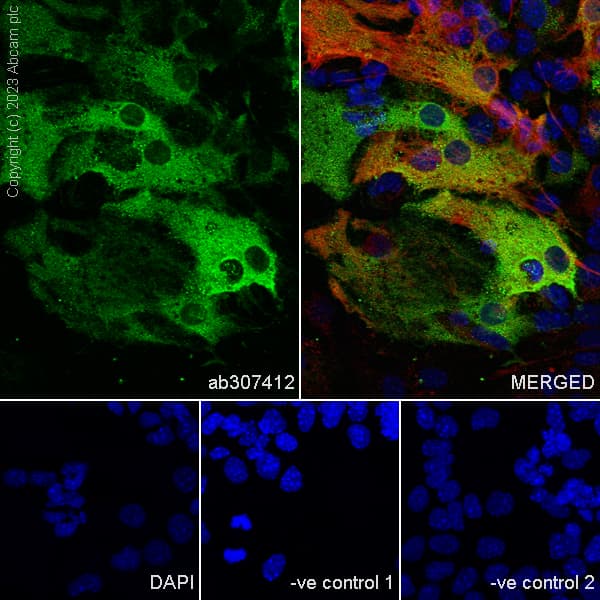 Anti-Aldolase C - C-terminal antibody [EPR26896-2] - BSA and Azide free(AB307413)