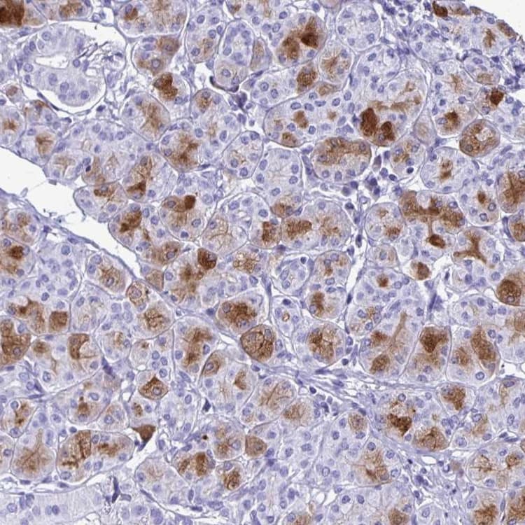 Cystatin D Antibody Ab254963  Immunohistochemistry Formalin Pfa Fixed Paraffin Embedded Sections Img111958