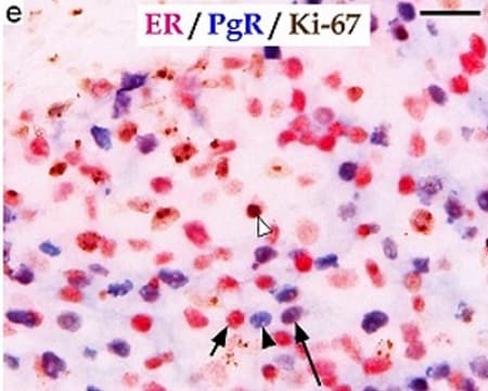 Anti-Ki67 antibody [EPR3610](AB92742)