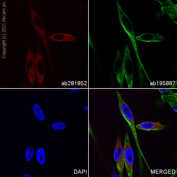 Alexa Fluor® 594 Anti-MelanA antibody [EP1422Y](AB281852)