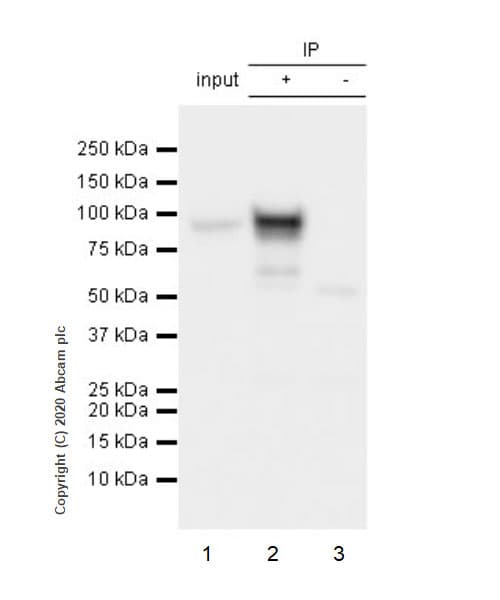 Anti-beta Catenin antibody [E247] - ChIP Grade(AB32572)