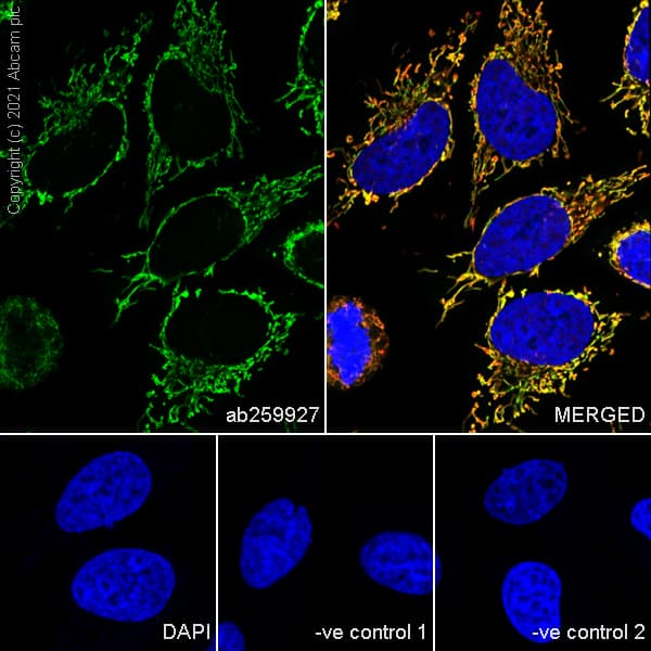Anti-LRPPRC/GP130 antibody [EPR24052-38](AB259927)