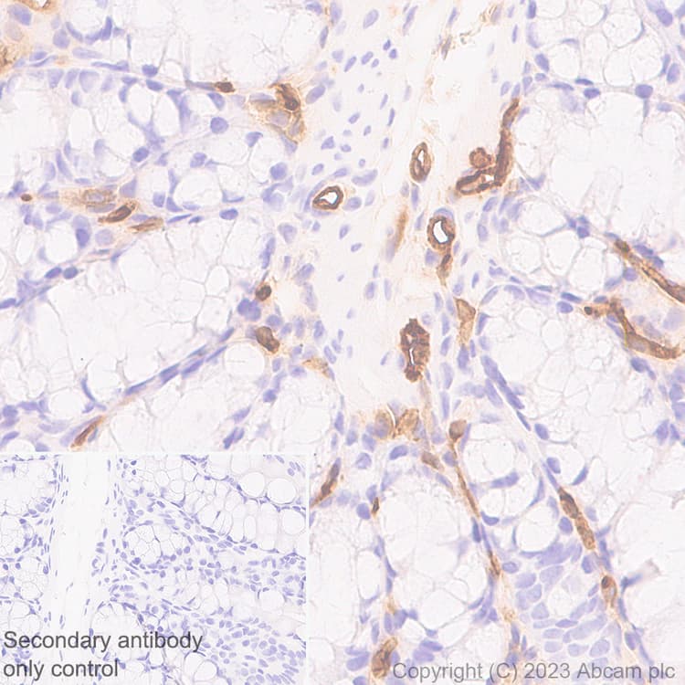 Anti-Ly6c antibody [EPR27220-23](AB314120)